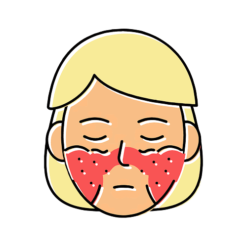 Systemic Lupus Erythematosus
